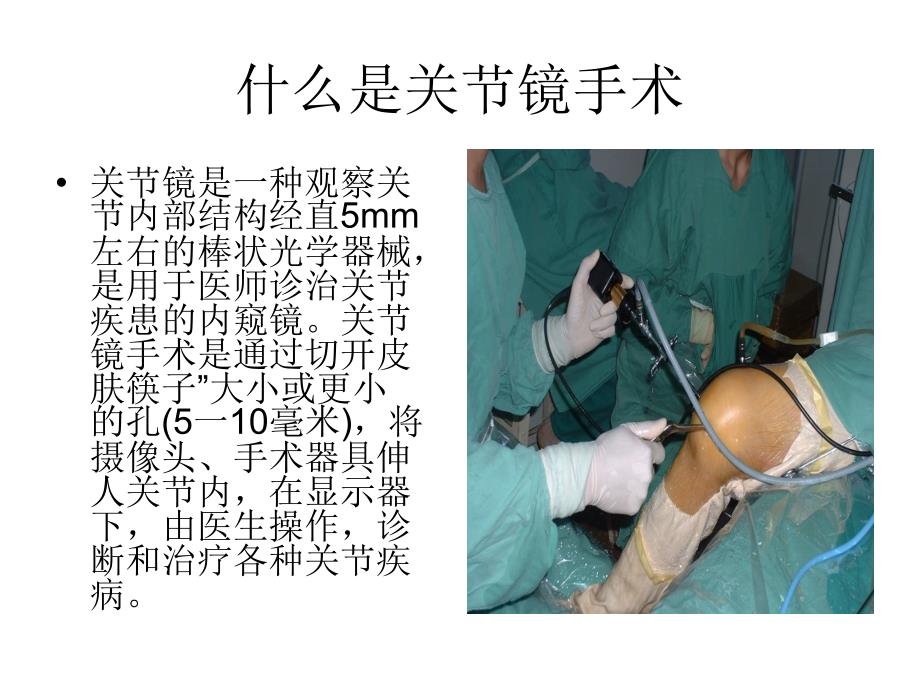 关节镜手术的护理配合.ppt_第2页