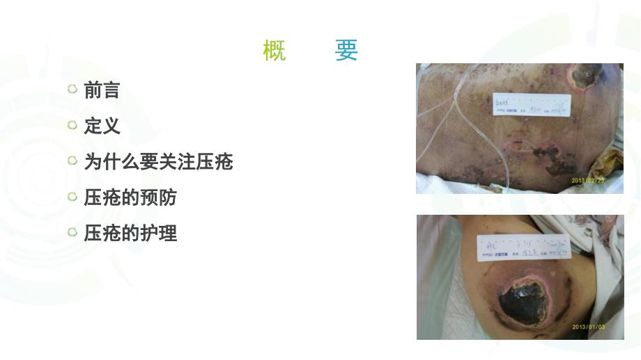 压力性损伤的预防与护理.ppt_第2页