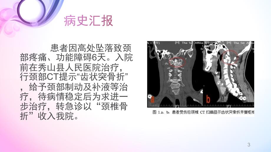优质课件疑难病例讨论颈椎骨折术后.ppt_第3页
