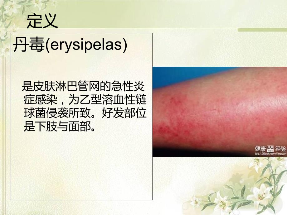 丹毒护理知识.ppt_第3页