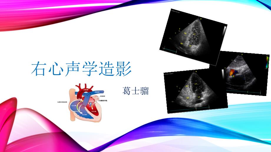 右心声学造影课件.pptx_第1页