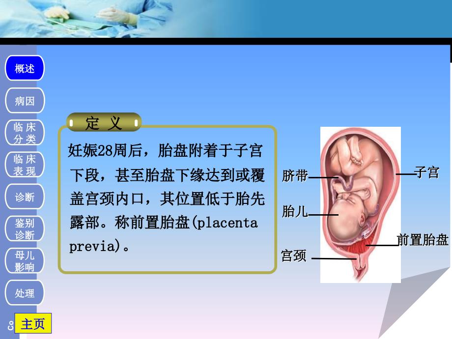前置胎盘胎盘早剥.ppt_第3页