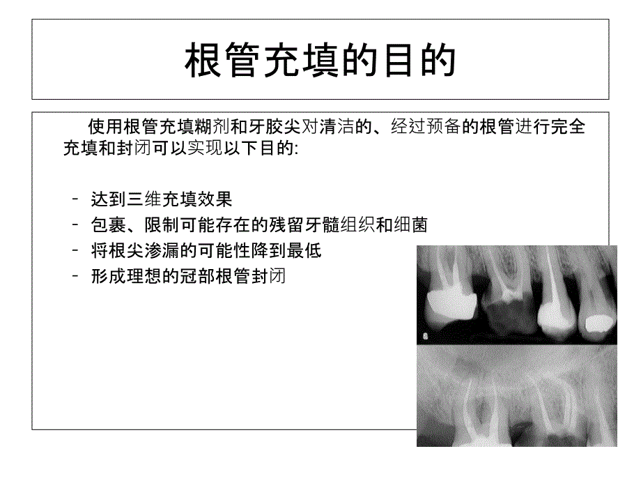 口腔医学总结热牙胶充填.ppt_第3页