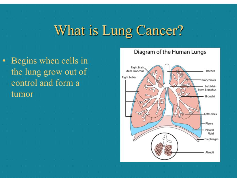 优选讲课肺癌英文课件.ppt_第2页