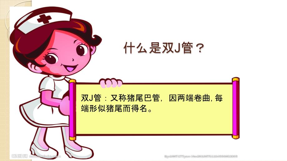 双J管的护理PPT课件.pptx_第3页