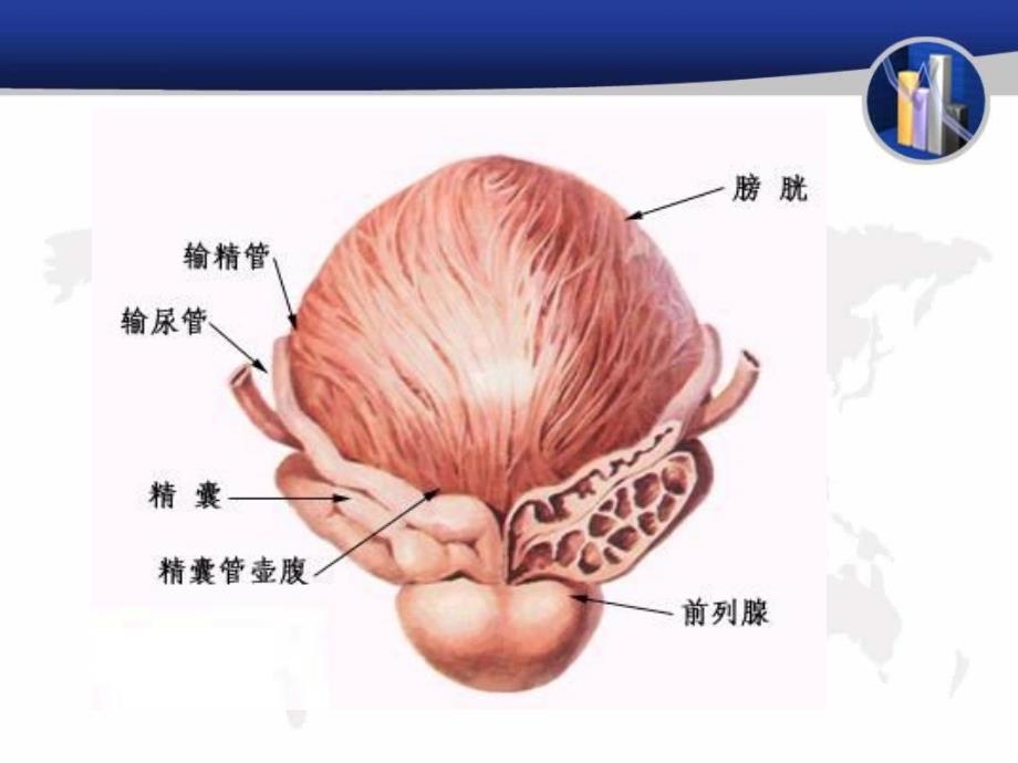 前列腺增生PPT课件.ppt_第3页