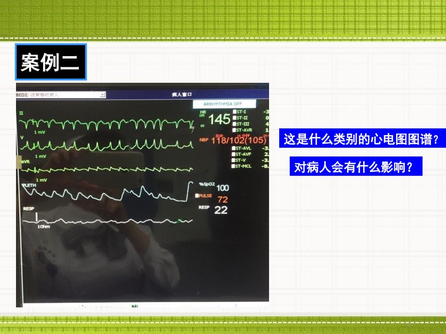 优质课件医护合作.ppt_第3页