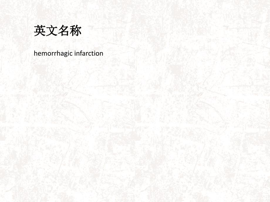 出血性脑梗死.ppt_第2页