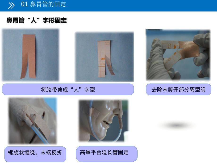 各种常见留置管道的固定方法及注意事项.ppt_第3页