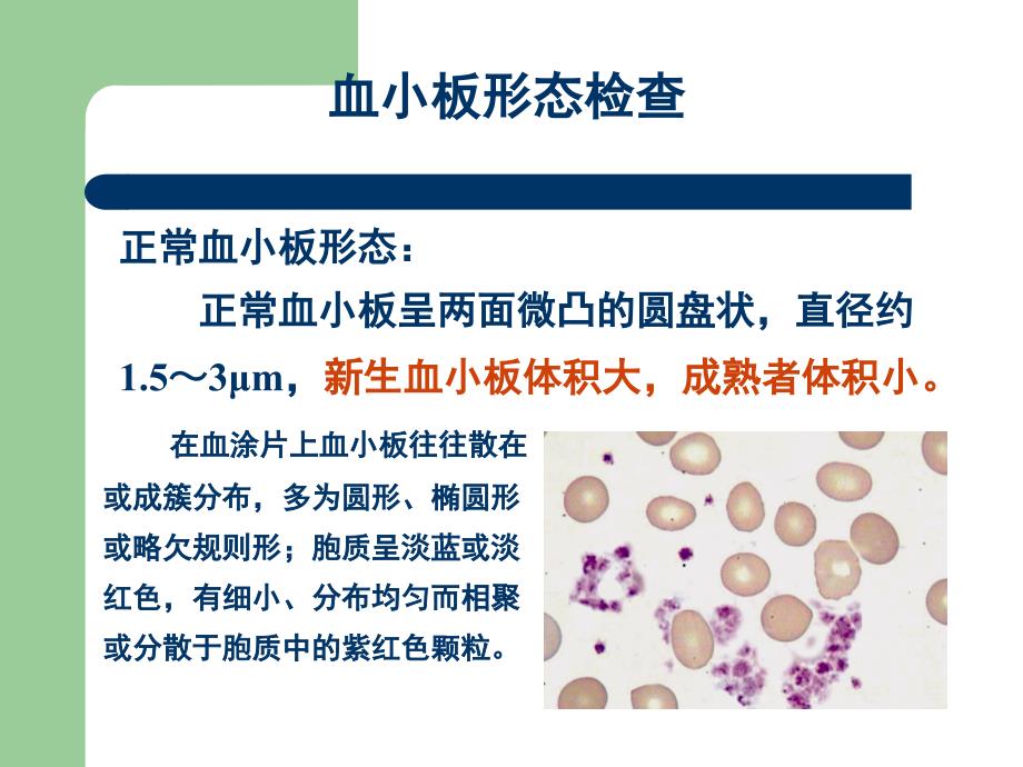 四血小板计数课件.ppt_第3页