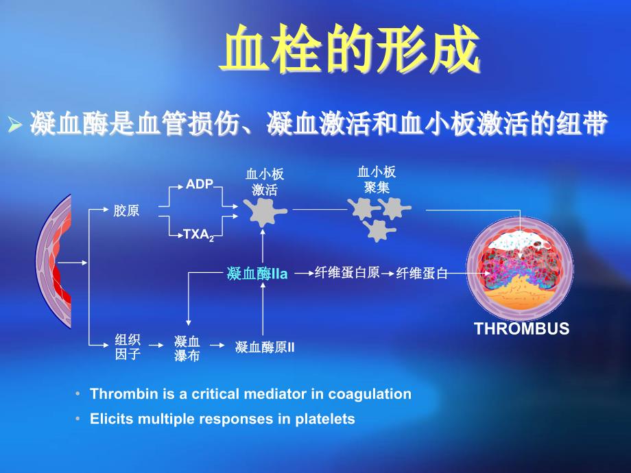 创伤科DVT预防.ppt_第3页