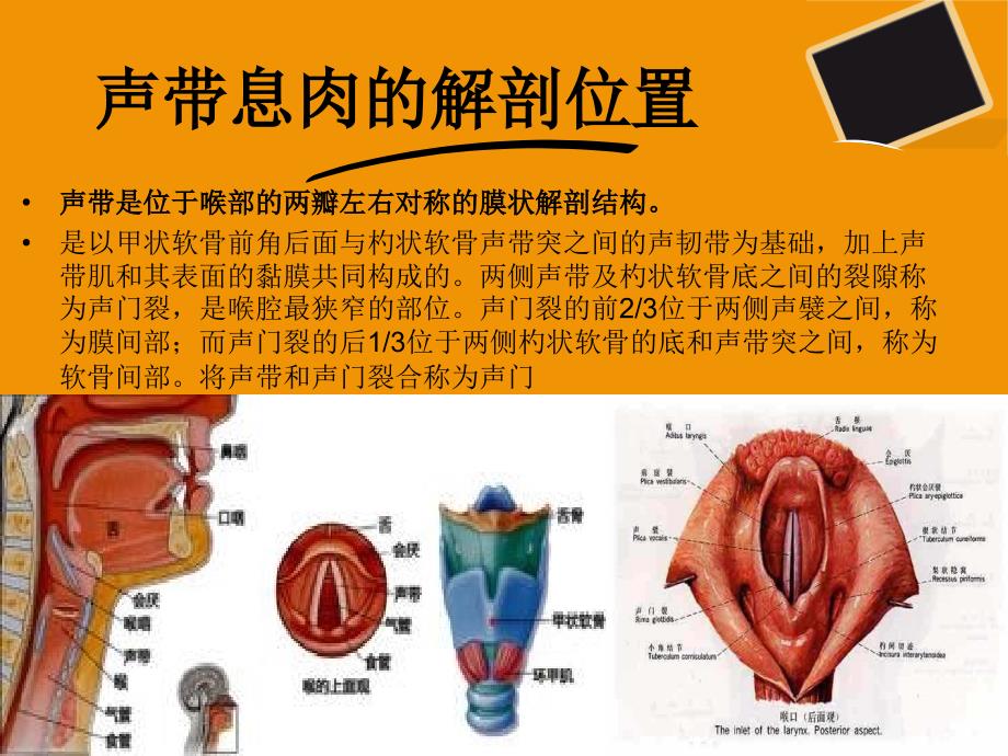 声带息肉PPT参考课件.ppt_第3页