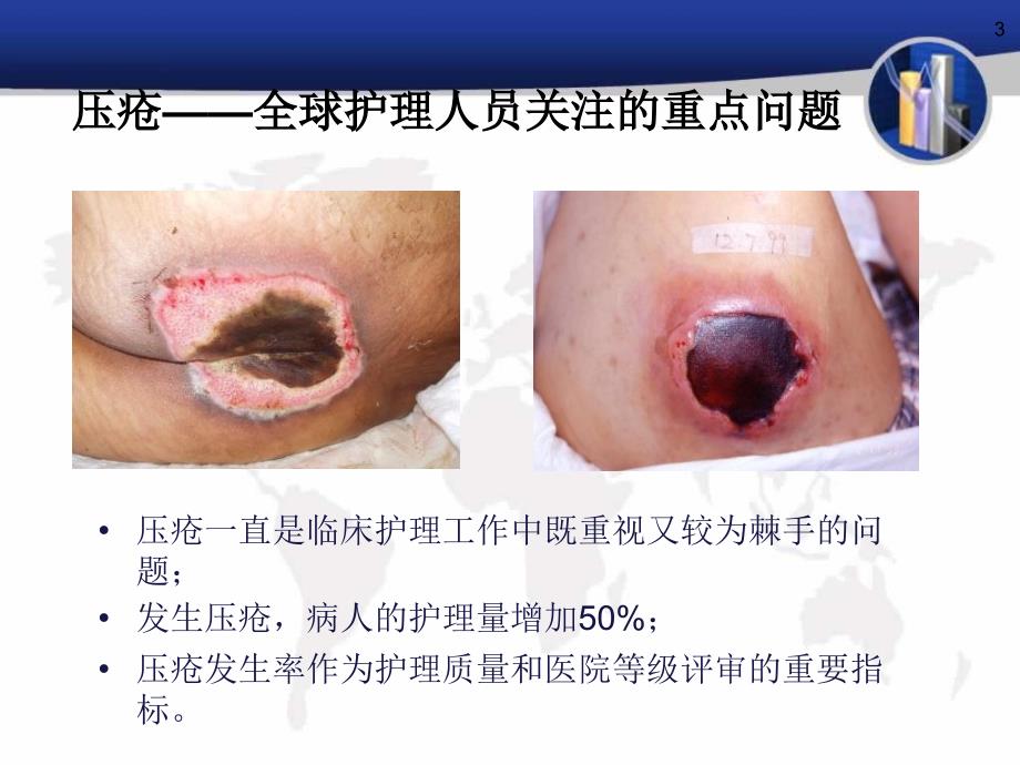 压疮的预防护理讲课.ppt_第3页