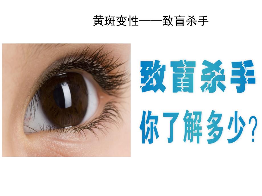 图说黄斑变性.ppt_第3页