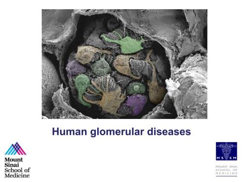 内科学英文课件Humanglomerulardiseases.ppt