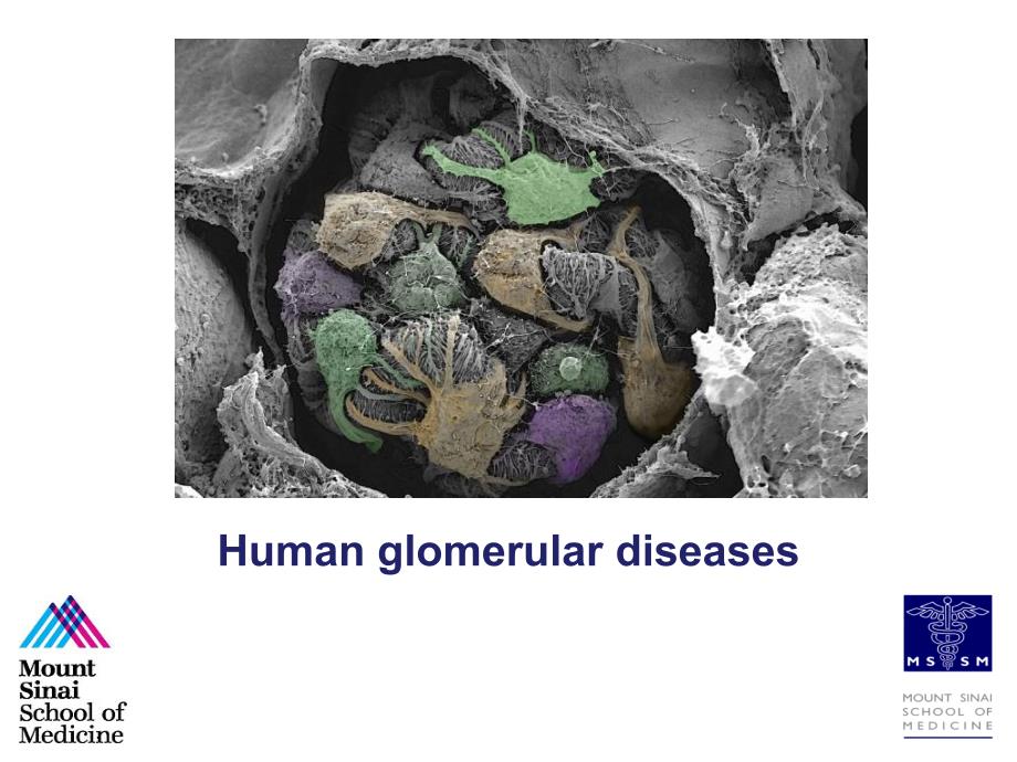 内科学英文课件Humanglomerulardiseases.ppt_第1页
