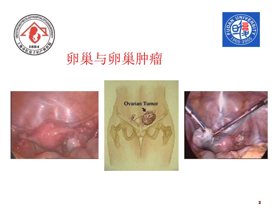 卵巢与卵巢肿瘤PPT课件.ppt_第2页