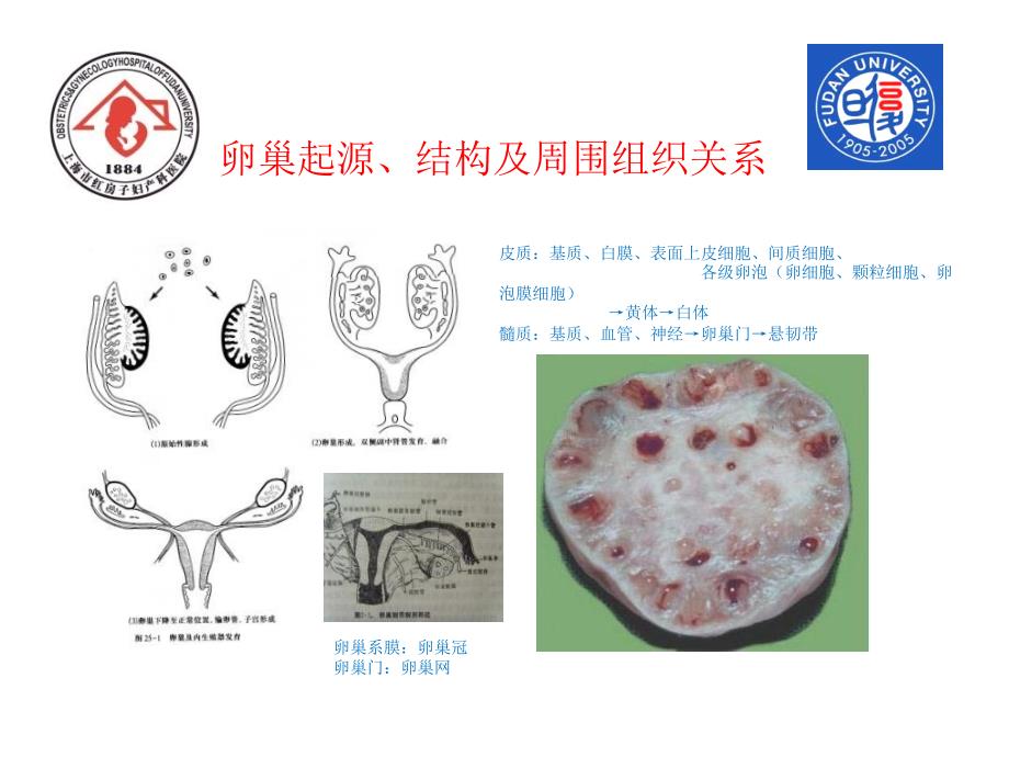 卵巢与卵巢肿瘤PPT课件.ppt_第3页