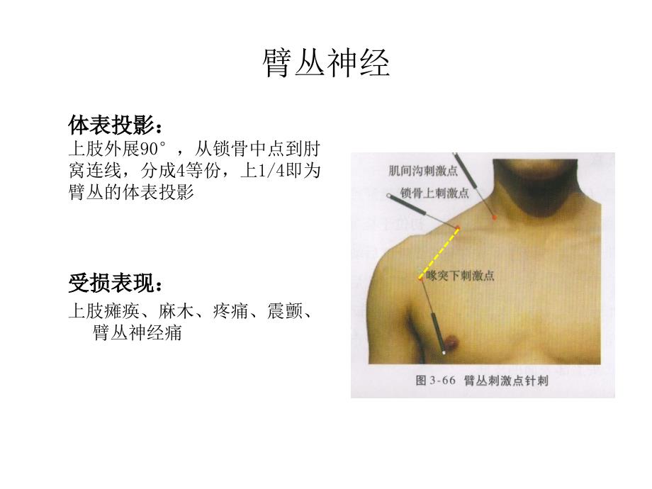 周围神经体表投影.ppt_第2页