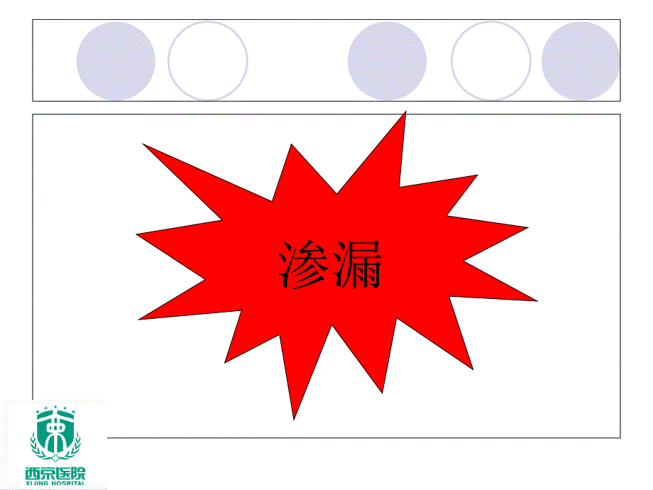 多巴胺渗漏的原因分析及护理.ppt_第2页