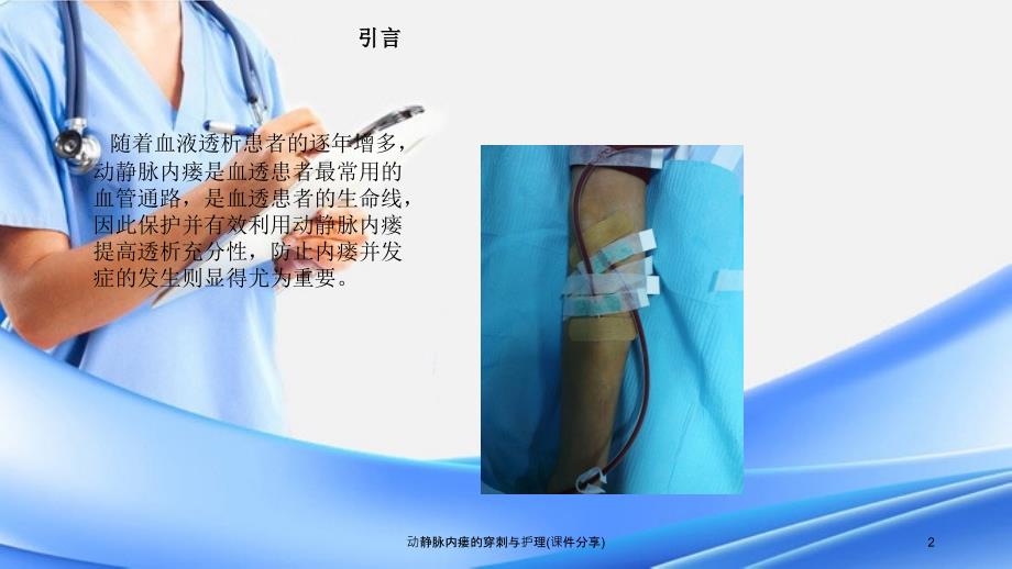动静脉内瘘的穿刺与护理课件分享.ppt_第2页