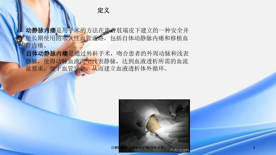 动静脉内瘘的穿刺与护理课件分享.ppt_第3页