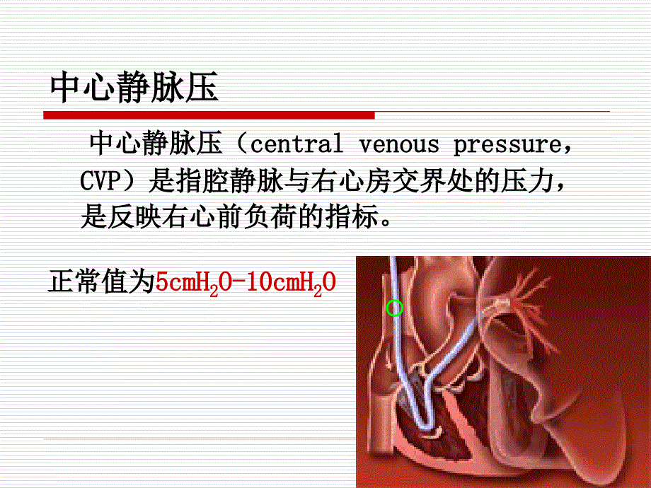 中心静脉压监测课件.ppt_第3页