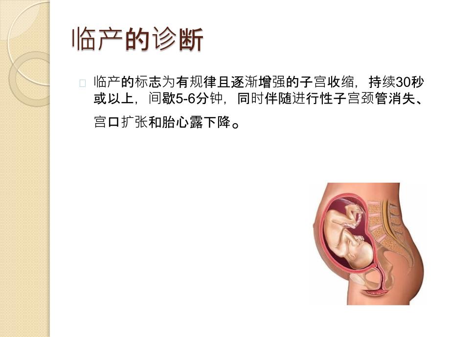 导乐分娩PPT课件.ppt_第3页