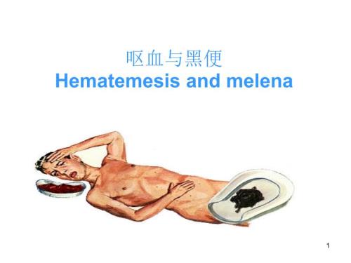 呕血与黑便PPT课件.ppt