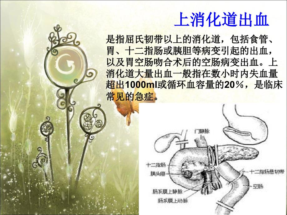 上消化道出血的急救与护理.ppt_第3页