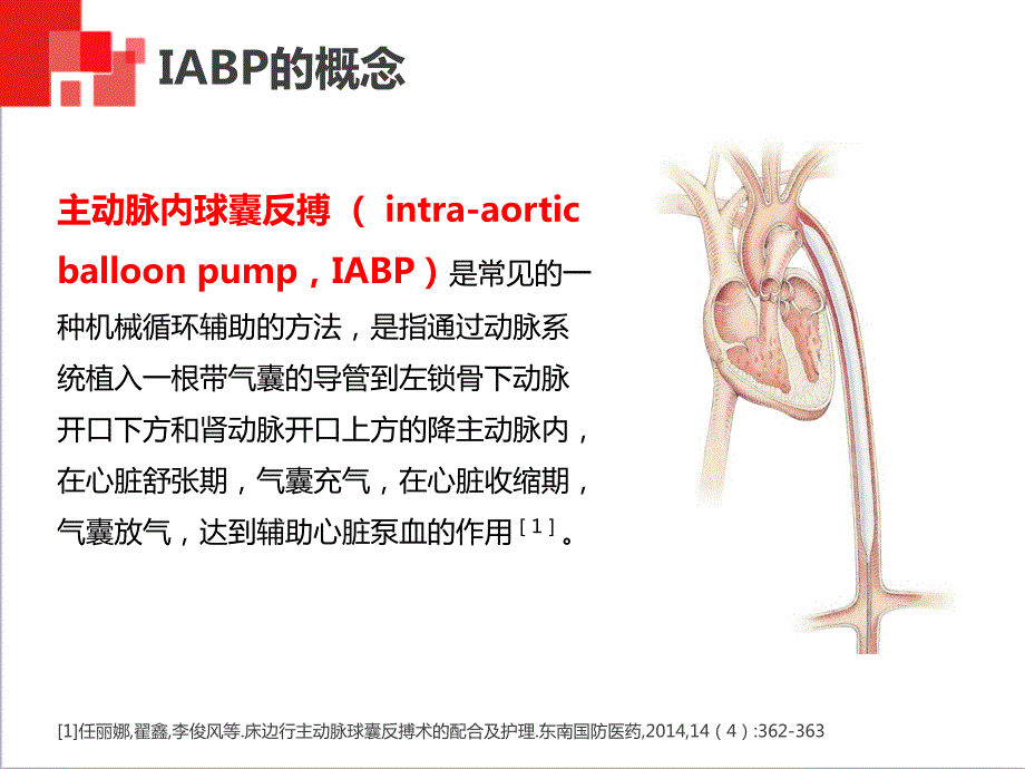 主动脉球囊反搏术IABP监测及护理.ppt_第3页
