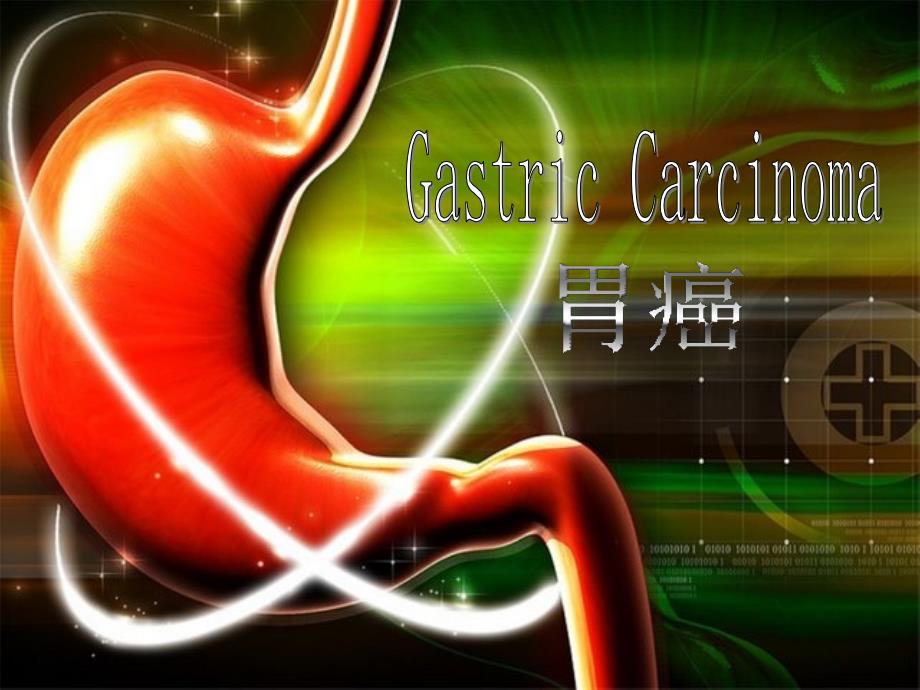 医学英语疾病介绍gastriccarcinoma胃癌ppt课件.ppt_第1页