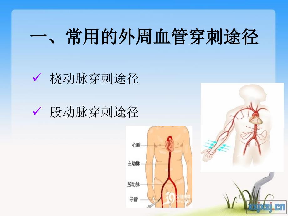 冠脉介入术后护理要点.ppt_第2页