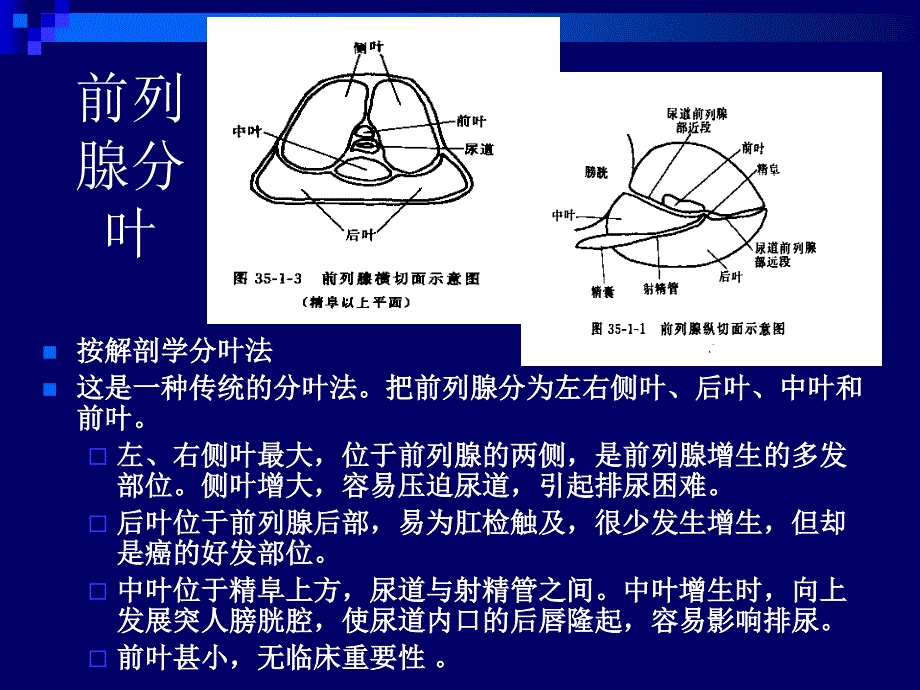 前列腺超声PPT课件.ppt_第3页
