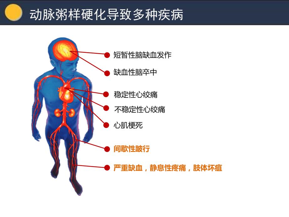 下肢动脉硬化闭塞症.ppt_第3页