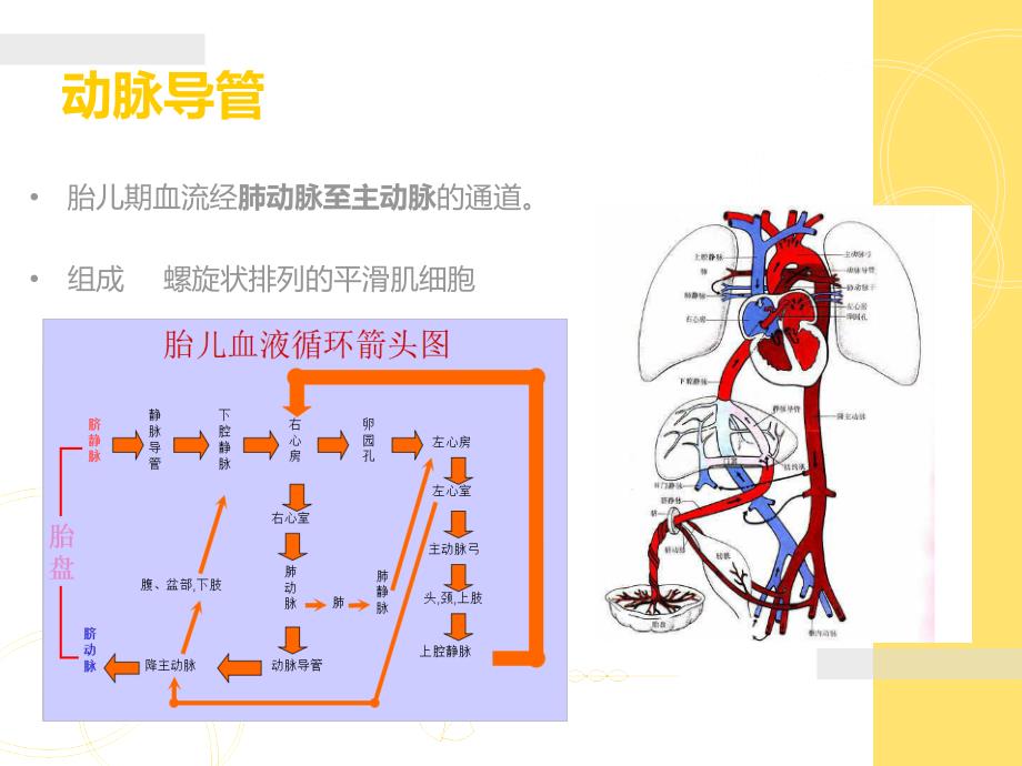 动脉导管未闭ppt.ppt_第2页