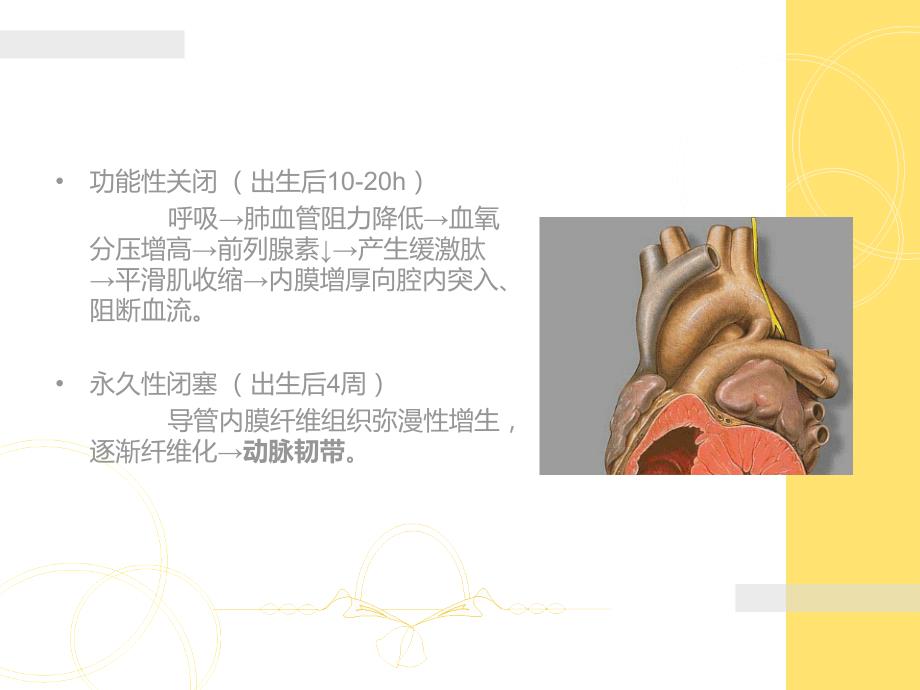 动脉导管未闭ppt.ppt_第3页