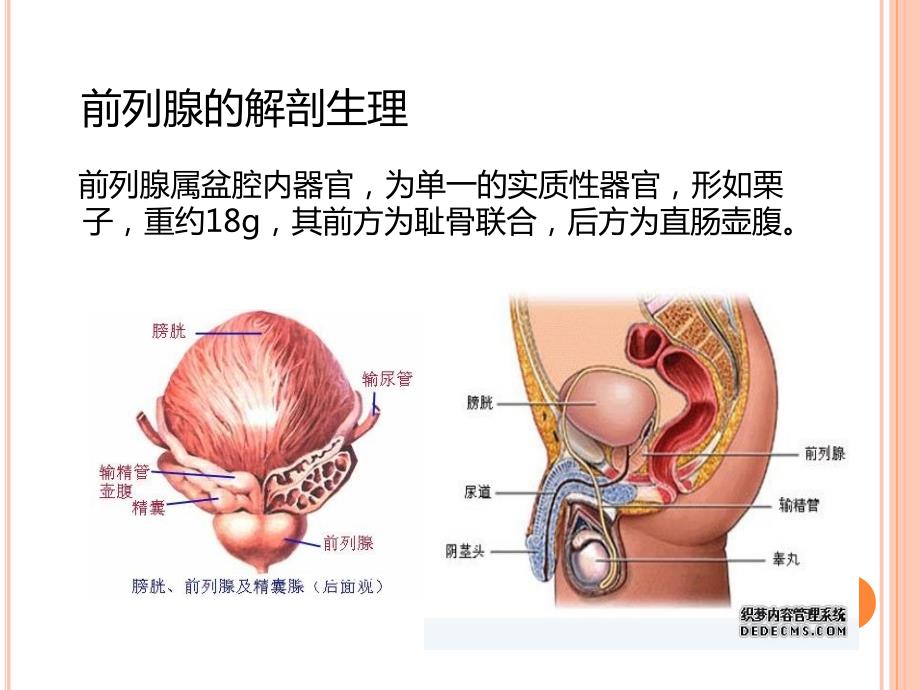 前列腺癌护理PPT课件.ppt_第3页
