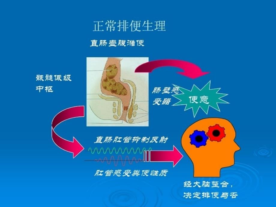 先天性巨结肠PPT课件.ppt_第3页