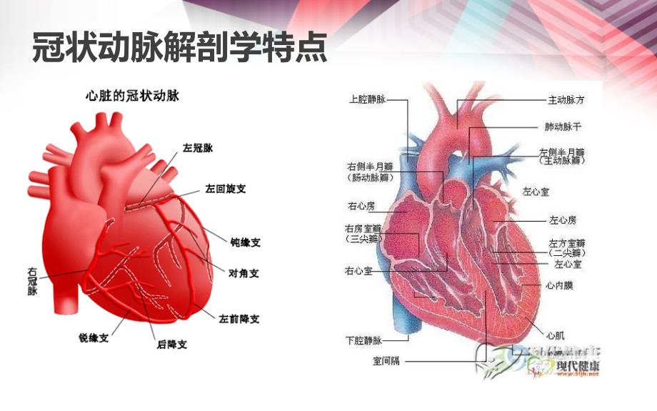 冠脉造影术PPT课件.ppt_第3页