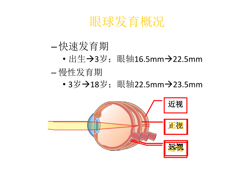 儿童屈光的特点与屈光不正的处理.ppt_第3页