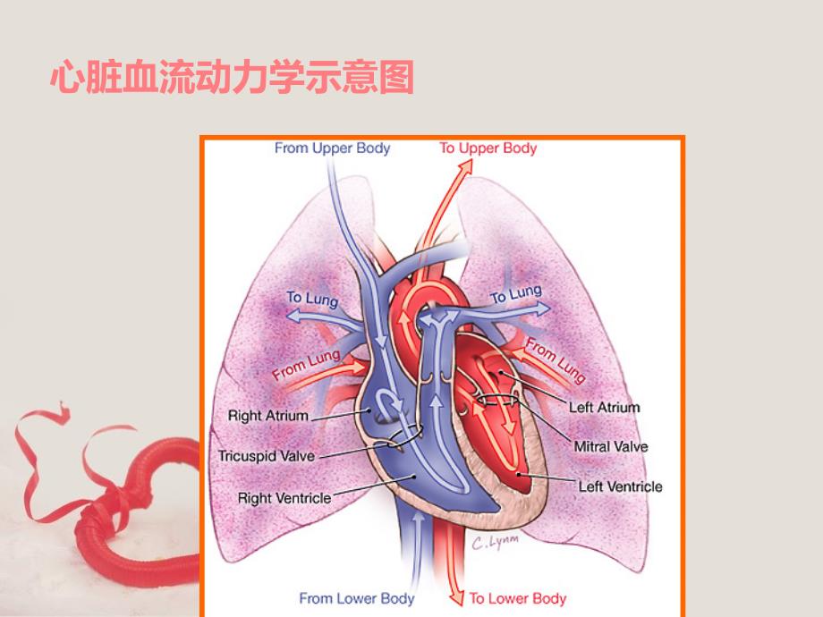 二尖瓣关闭不全的护理查房.ppt_第2页