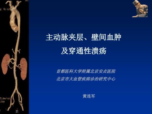 主动脉夹层壁间血肿及穿通.ppt