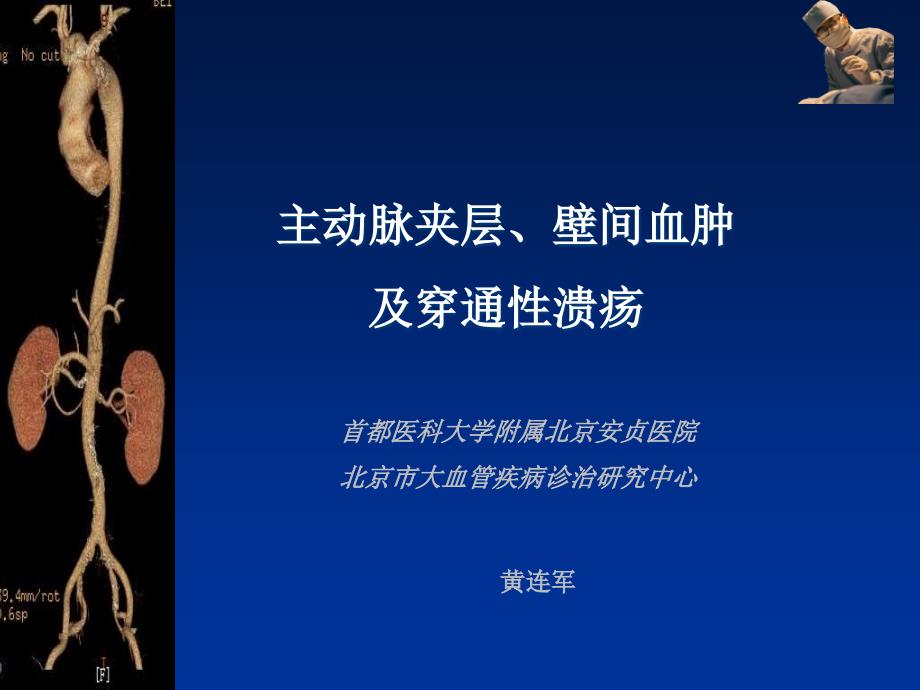 主动脉夹层壁间血肿及穿通.ppt_第1页