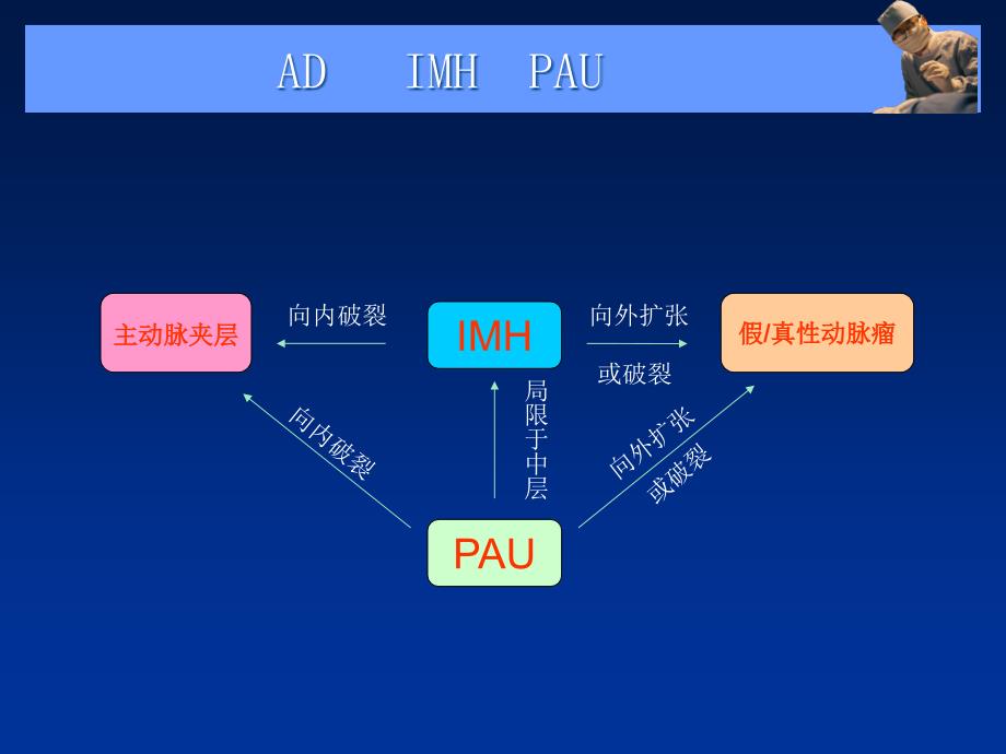主动脉夹层壁间血肿及穿通.ppt_第3页