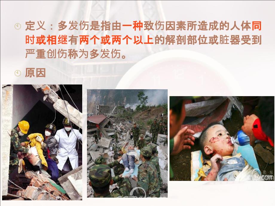 多发伤急救与流程.ppt_第2页