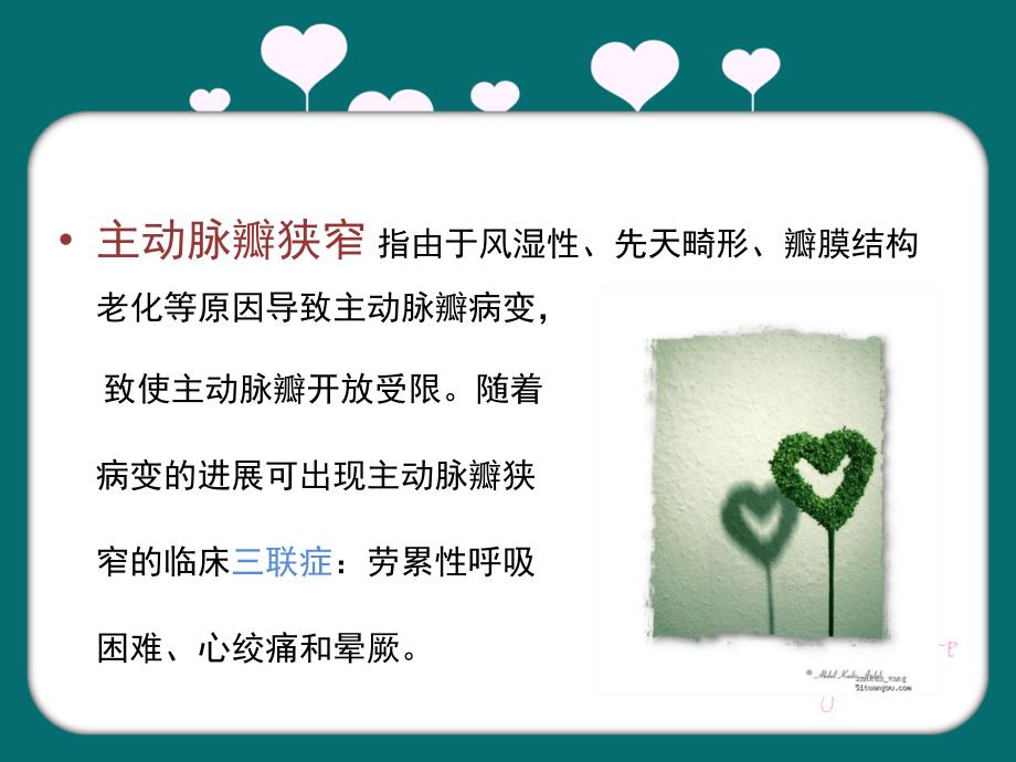 主动脉瓣狭窄ppt.ppt_第3页