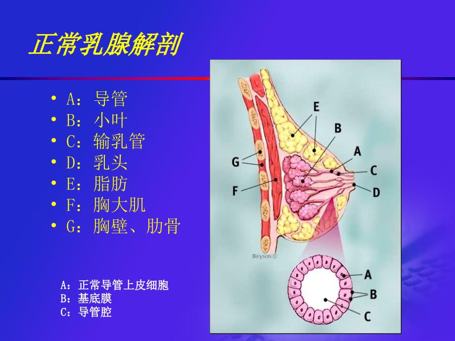 乳腺超声PPT课件.ppt_第3页