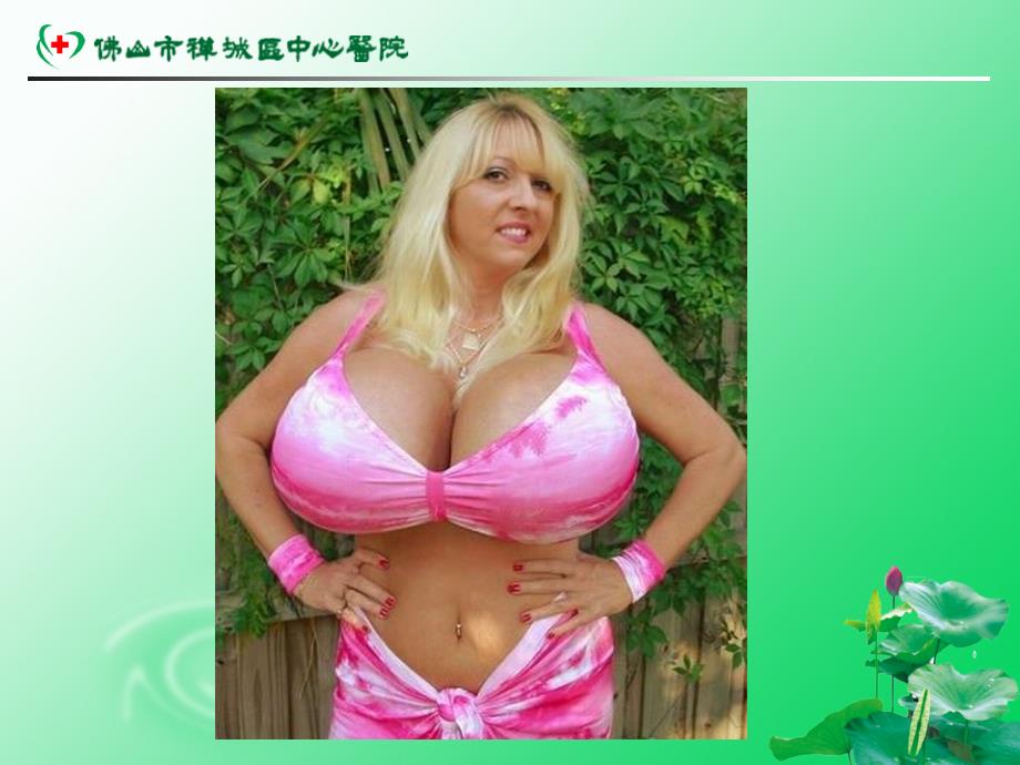 乳腺癌的防治PPT课件.ppt_第2页