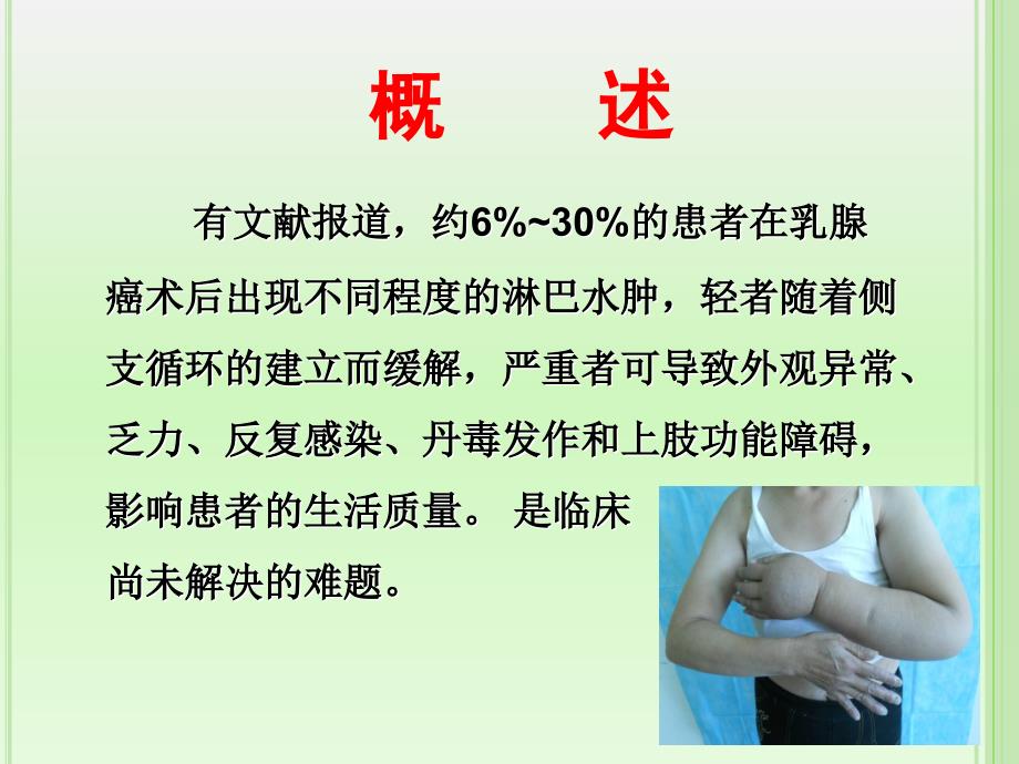 乳腺癌淋巴水肿的预防和治疗.PPT_第3页